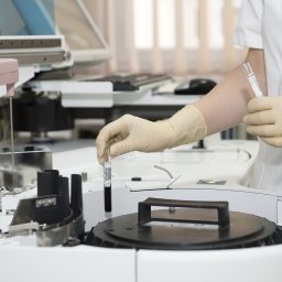 A health worker in a laboratory is performing a medical test using high-tech scientific equipment.